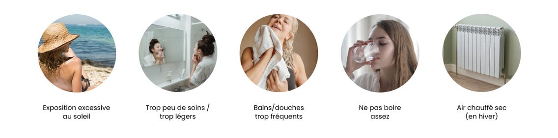 PSF / Trockene Haut erkennen & richtig pflegen