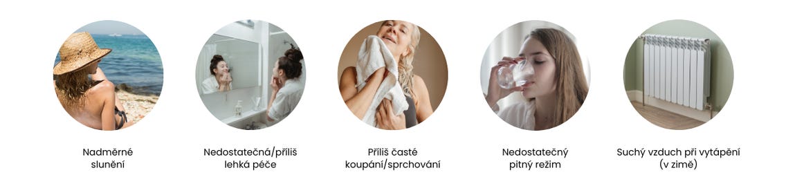 PSF / Trockene Haut erkennen & richtig pflegen