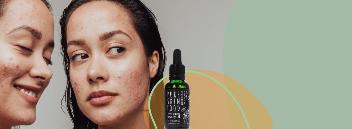 Pure Power per pelli impure e problematiche