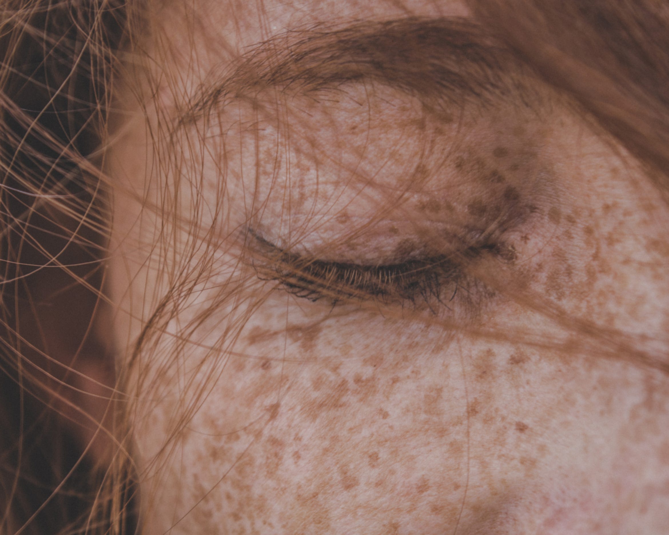 Sick Complexion Skin & Mental Health: How Stress Effects Your Complexion - PURE SKIN FOOD